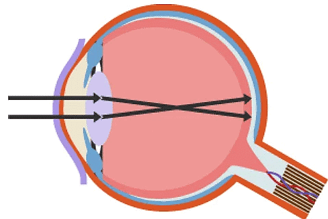 The Eye | Biology for Grade 10