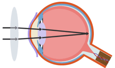 The Eye | Biology for Grade 10