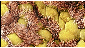 Cilliated cells reduce the amount of mucus and pathogens entering the lungs