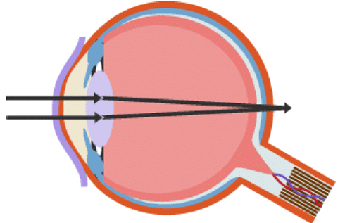 The Eye | Biology for Grade 10
