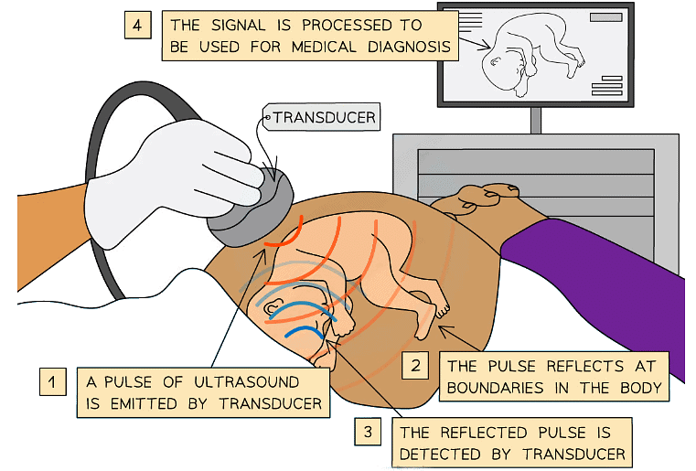 Ultrasound can be used to construct an image of a foetus in the womb