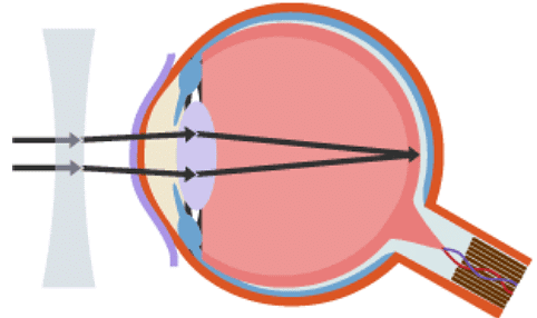 The Eye | Biology for Grade 10