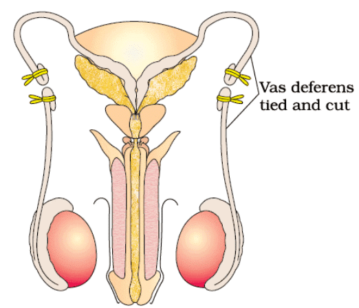 NCERT Summary: Reproductive Health | Science & Technology for UPSC CSE