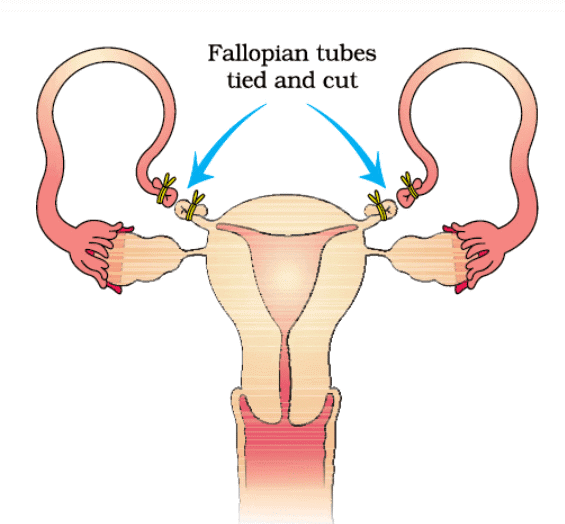 NCERT Summary: Reproductive Health | Science & Technology for UPSC CSE