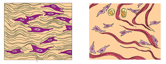 (a) Dense regular (b) Dense irregular 