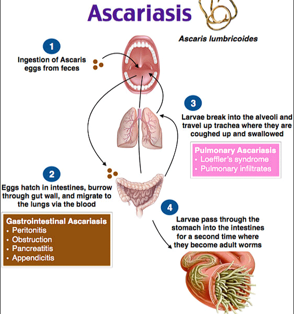 Mode of Transmission Ascariasis