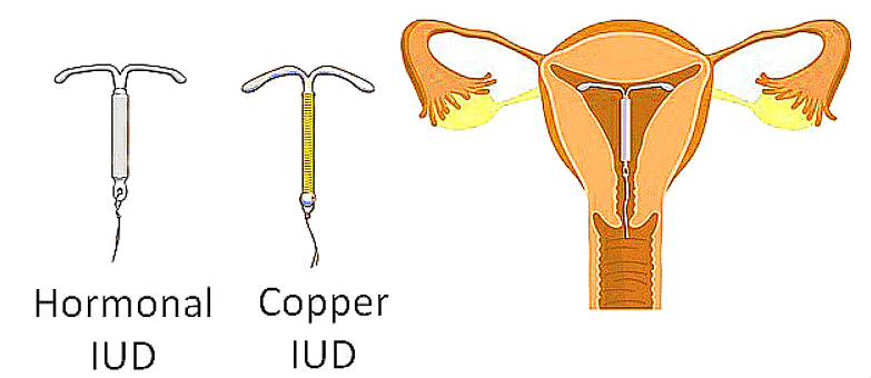Important Diagrams: Reproductive Health | Biology Class 12 - NEET