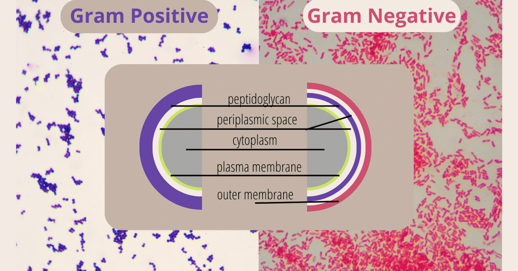 Gram-positive & Gram-negative