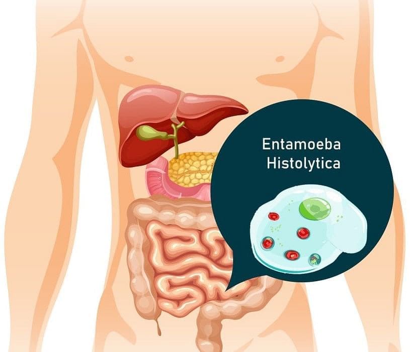 Entamoeba Histolyica in Human Gut