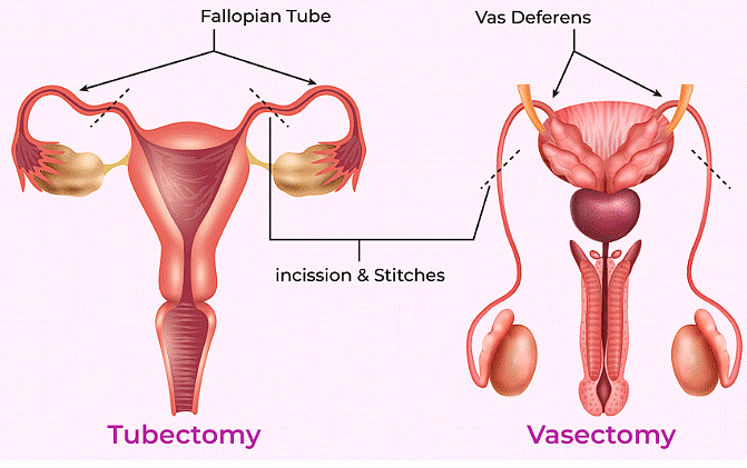 Important Diagrams: Reproductive Health | Biology Class 12 - NEET
