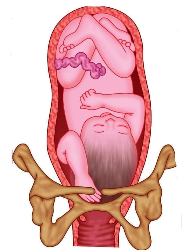 Compound presentation