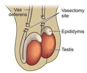 Birth Control, Contraception & Medical Termination of Pregnancy | Biology Class 12 - NEET