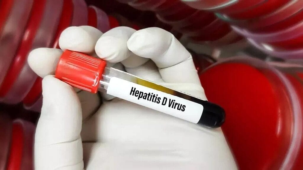 WHO Classifies Hepatitis D as Carcinogenic