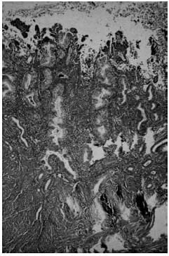 Folliculogenesis and the `Follicular Phase`