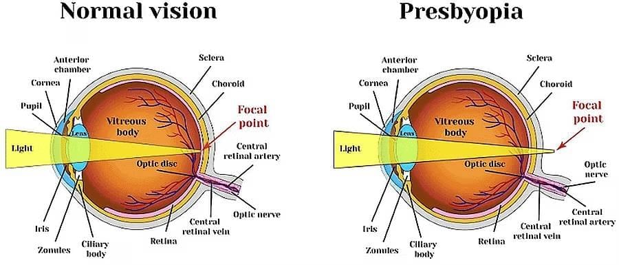 Lenses Chapter Notes | Physics for EmSAT Achieve