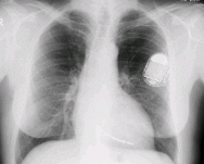 X Rays: Atomic Origins and Applications | Modern Physics for IIT JAM