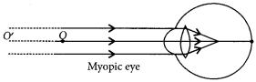 Unit Test (Solutions): The Human Eye and The Colourful World | Science Class 10