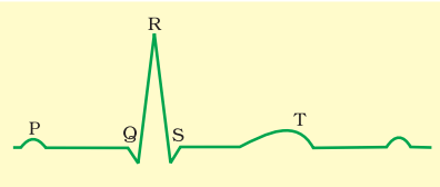 Diagrammatic presentation of a standard ECG