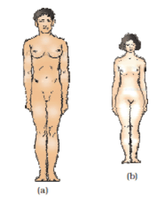 Diagrammatic representation of genetic disorders due to sex chromosome composition in humans : (a) Klinefelter Syndrome; (b) Turner’s Syndrome