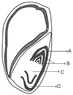 Diagram-based Previous Year Questions