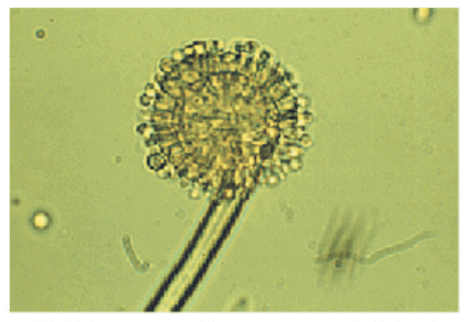 Revision Notes: Biological Classification | Biology Class 11 - NEET