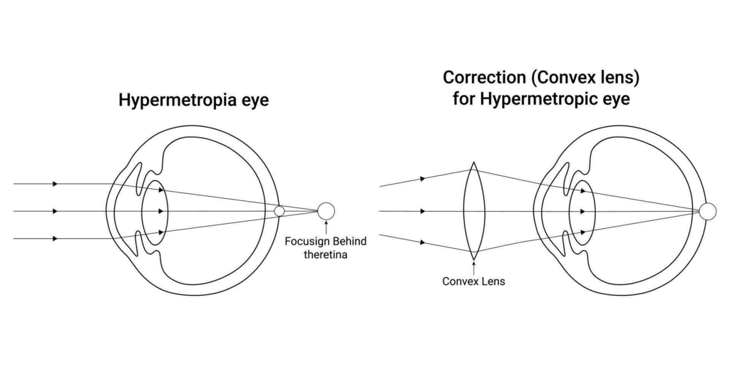 Class 10 Science Chapter 10 Previous Year Questions - The Human Eye and the Colourful World