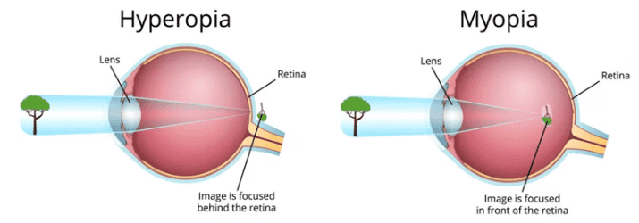 Class 10 Science Chapter 10 Practice Question Answers - Human Eye and Colourful World