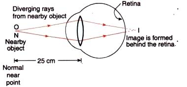 Lakhmir Singh & Manjit Kaur: The Human Eyes And The Colorful World, Solutions- 3 | Science Class 10