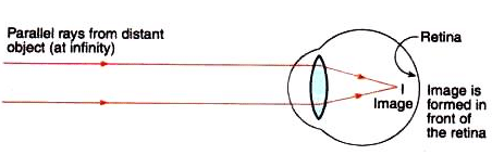 Lakhmir Singh & Manjit Kaur: The Human Eyes And The Colorful World, Solutions- 3 | Science Class 10