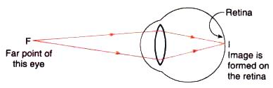 Lakhmir Singh & Manjit Kaur: The Human Eyes And The Colorful World, Solutions- 3 | Science Class 10