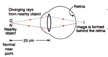 Lakhmir Singh & Manjit Kaur: The Human Eyes And The Colorful World, Solutions- 3 | Science Class 10