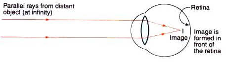 Lakhmir Singh & Manjit Kaur: The Human Eyes And The Colorful World, Solutions- 3 | Science Class 10
