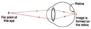 Lakhmir Singh & Manjit Kaur: The Human Eyes And The Colorful World, Solutions- 3 | Science Class 10