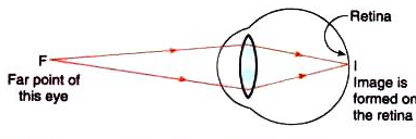 Lakhmir Singh & Manjit Kaur: The Human Eyes And The Colorful World, Solutions- 3 | Science Class 10