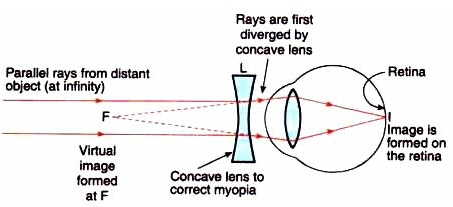 Lakhmir Singh & Manjit Kaur: The Human Eyes And The Colorful World, Solutions- 3 | Science Class 10