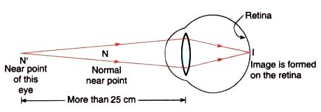 Lakhmir Singh & Manjit Kaur: The Human Eyes And The Colorful World, Solutions- 3 | Science Class 10