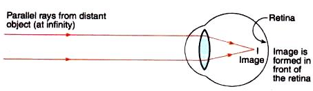 Lakhmir Singh & Manjit Kaur: The Human Eyes And The Colorful World, Solutions- 3 | Science Class 10