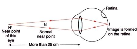 Lakhmir Singh & Manjit Kaur: The Human Eyes And The Colorful World, Solutions- 3 | Science Class 10