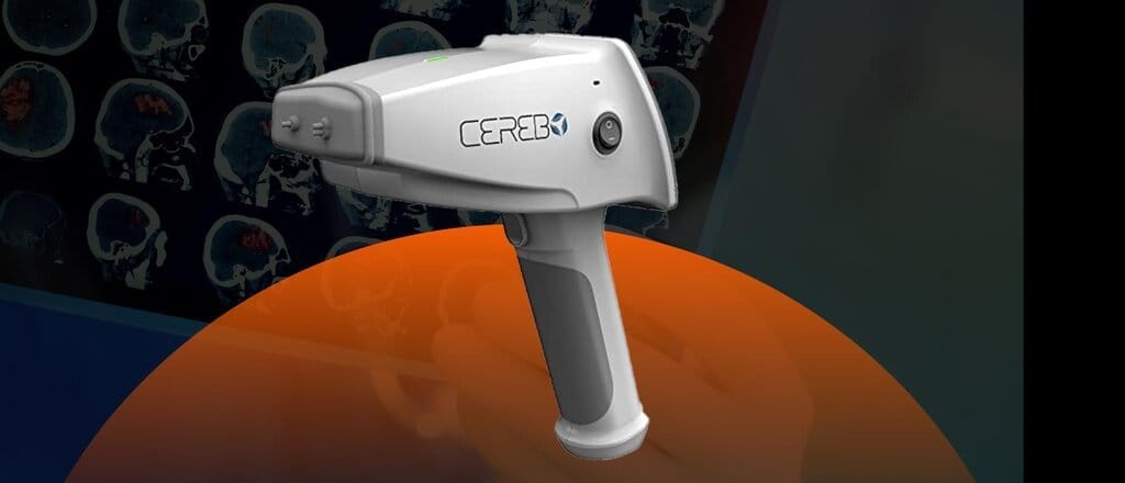 ICMR Introduces `CEREBO` to Diagnose Brain Injury