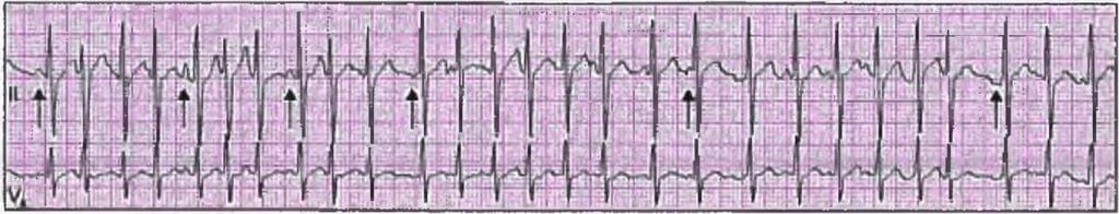 Cardiology Chapter Notes | Medicine - NEET PG