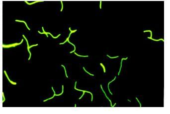 Solved Examples: Biological Classification | NCERT Exemplar & Revision Notes for NEET