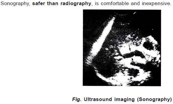 Chapter Notes - Immunity and Disease, Class 12, Biology (AIPMT)