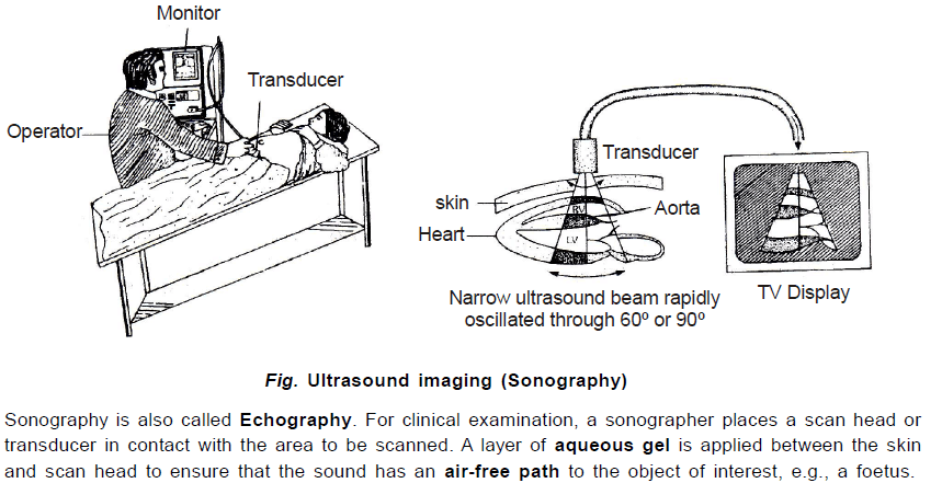 Chapter Notes - Immunity and Disease, Class 12, Biology (AIPMT)
