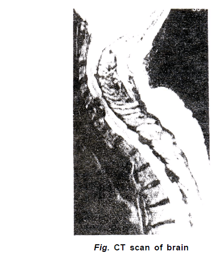 Chapter Notes - Immunity and Disease, Class 12, Biology (AIPMT)