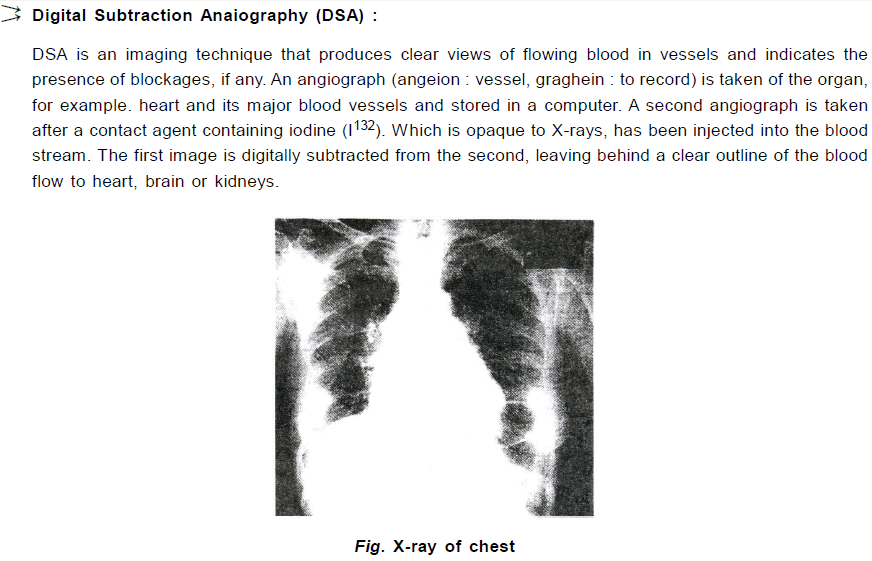 Chapter Notes - Immunity and Disease, Class 12, Biology (AIPMT)