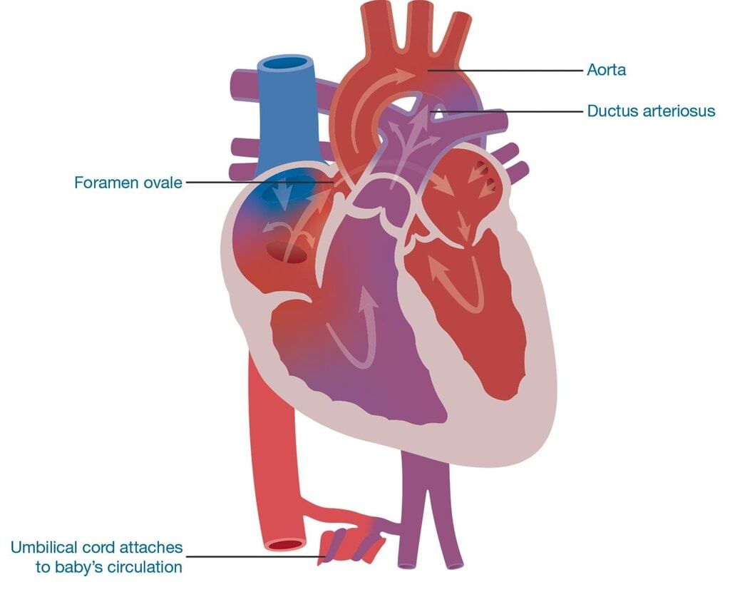 Infanticide Foeticides and Child Abuse Chapter Notes | Forensic Medicine and Toxicology (FMT) - NEET PG