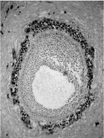 Folliculogenesis and the `Follicular Phase`
