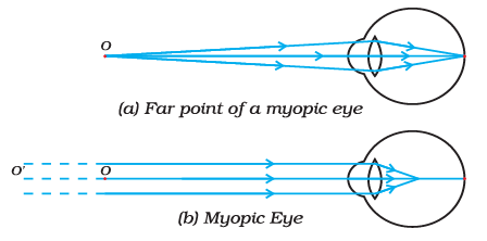 Diagram Based Questions: The Human Eye and the Colourful World | Science Class 10
