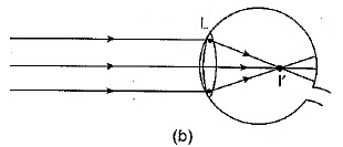 Class 10 Science Chapter 10 Previous Year Questions - The Human Eye and the Colourful World