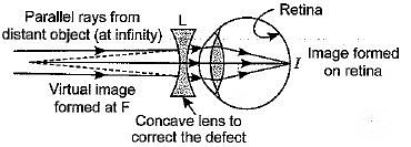 Class 10 Science Chapter 10 Previous Year Questions - The Human Eye and the Colourful World